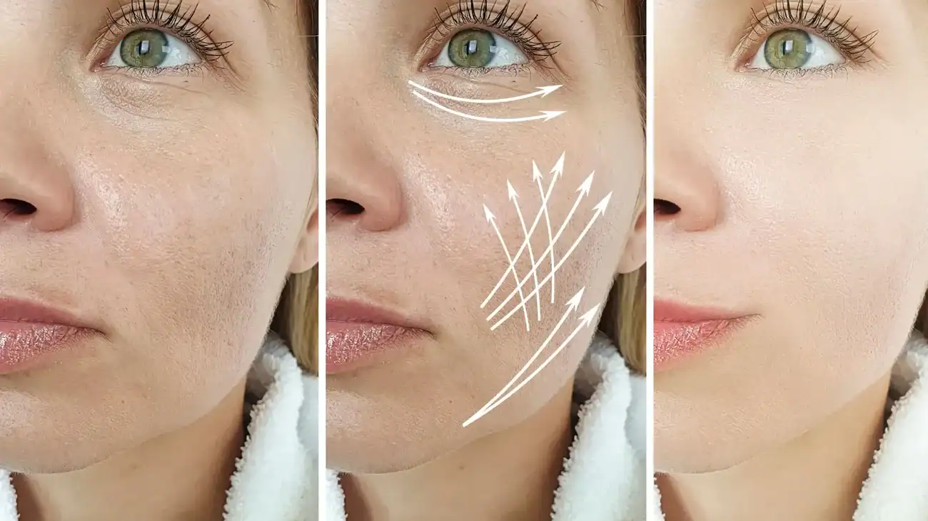 Can One Treatment Really Tackle More Than One Skin Concern Lewisham?