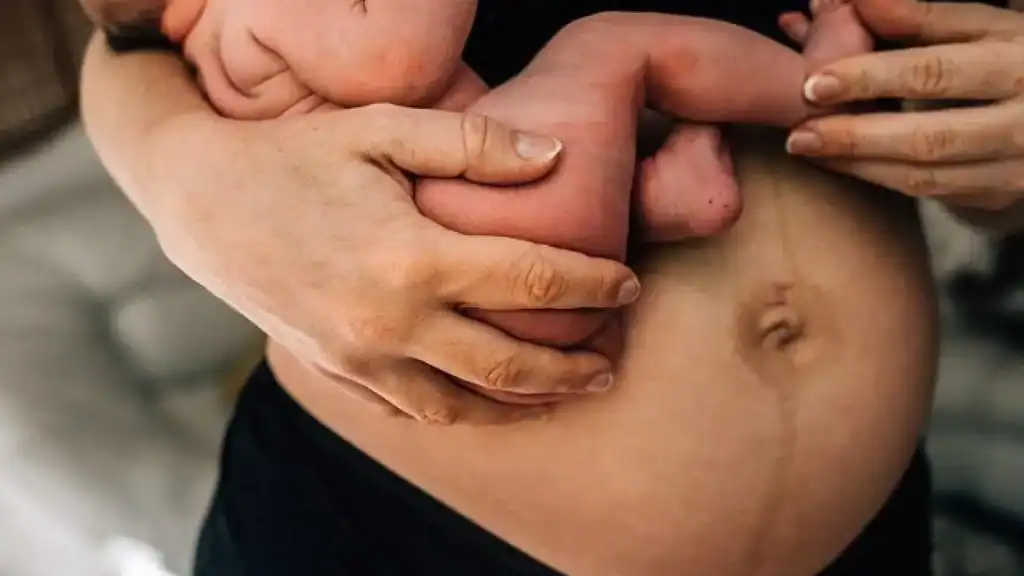 Why Is My Stomach Still Big After Pregnancy Lewisham?